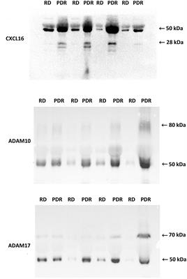 Evaluation of Proteoforms of the Transmembrane Chemokines CXCL16 and CX3CL1, Their Receptors, and Their Processing Metalloproteinases ADAM10 and ADAM17 in Proliferative Diabetic Retinopathy